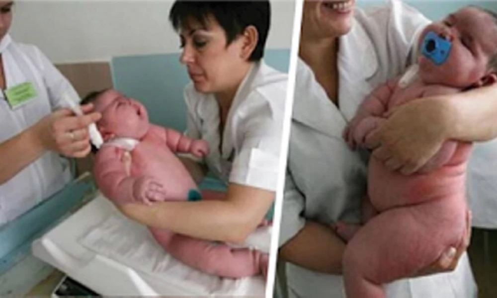 Αυστραλία: Μωρό γεννήθηκε 18 κιλά!